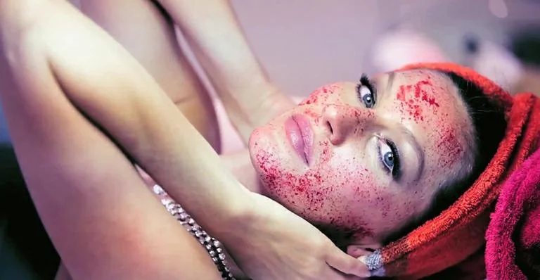 Tratamento facial com plasma rico em plaquetas, o Vampire Facelift